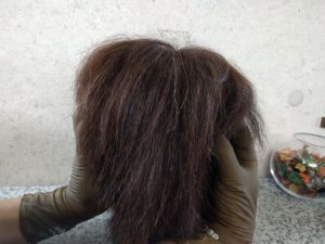 育毛と発毛より大事、抜け毛予防編!抜け毛予防シャンプーを学んでハゲ対策!アラサー男子の薄毛対策。シャンプー編。